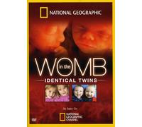 in The Womb: Indentical Twins