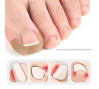 INF Patchs de correction pour ongles incarnés - 10 pièces