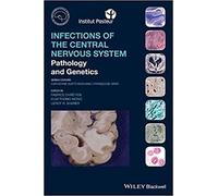 Infections Of The Central Nervous System