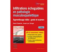 Infiltrations Échoguidées En Pathologie Musculosquelettique - Apprentissage Vidéo : Geste Et Examen
