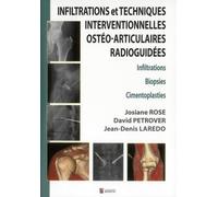 Infiltrations et techniques interventionnelles osteo-articulaires radioguidees Infiltrations, biopsies, cimentoplasties - Jean-Denis Laredo - Sauramps Medical - broché - Scolaire / Universitaire