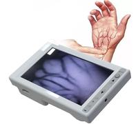 Instrument d'imagerie capillaire veineux avec écran LCD et réglage de la luminosité infrarouge for hôpitaux et cliniques