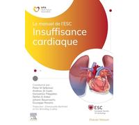 Insuffisance cardiaque