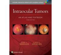 Intraocular Tumors: An Atlas And Textbook
