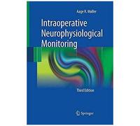 Intraoperative Neurophysiological Monitoring