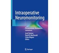 Intraoperatives Neuromonitoring: Fundamentals, Possibilities, Limitations