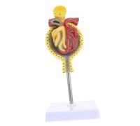 Ipetboom Modèle Anatomique de Glomérule avec Base pour Enseignement et Physiologie