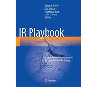 Ir Playbook