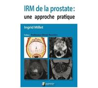 Irm De La Prostate : Une Approche Pratique