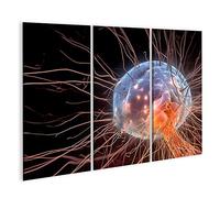 islandburner Prime Image sur toile « Intelligence humaine » avec cerveau numérique et neurones