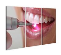 islandburner Tableau sur toile pour blanchiment des dents avec technologie LED chez le dentiste pour salle de bain patients cabinet dentaire images images murales poster