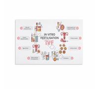 IVF Cycle Infographic Poster Fertility Educational Guide Canvas Wall-Art Home Decor
