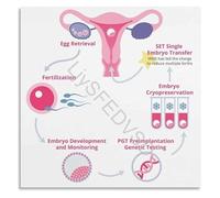 IVF Process Cycle Infographic Educational Poster Fertility Awareness Wall Art Canvas Print for Home Bedroom Living Room Decor(Unframed,12x18inch(30x45cm))