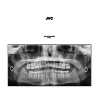 Jack Van Cleaf JVC (Vinyl) 12" Album
