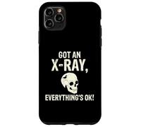 J'Ai passé Une radiographie, Tout va Bien. Radiographie Coque pour iPhone 11 Pro Max