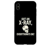 J'Ai passé Une radiographie, Tout va Bien. Radiographie Coque pour iPhone XS Max
