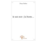 Je suis noir : j'ai honte...