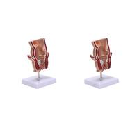 Jnchdghwa 2X Modèle D'Anatomie Modèle de LéSion HéMorroïDe Rectale Humaine Fistule HéMorroïDe Fistule Fissure Pathologie Modèle D'Enseignement