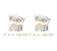 Jnchdghwa 2X Modèle de Dents de Maladie Typodonts Dentaires Modèle D'Implant de Dents avec Dents Amovibles Démonstration de Dents Standard par le Dentiste
