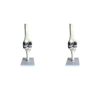 Jnchdghwa 2X Modèle de Simulation D'Articulation Du Genou, Chirurgie de Remplacement Du Ménisque, Ligaments, Cartilages, Modèle de Chirurgie, Articulation Artificielle Du Genou