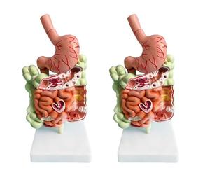 Jnchdghwa 2X Modèle de SystèMe Digestif Humain Anatomie de L'Estomac Gros Intestin Caecum Rectum DuodéNum Modèle de Structure des Organes Internes Humains