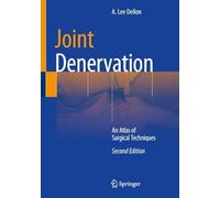 Joint Denervation: An Atlas of Surgical Techniques