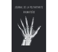 Journal de la polyarthrite rhumatoïde: Journal des médicaments, Journal guidé, journal pour hommes, journal pour femmes, suivi de l'humeur, Guerrier ... pour la polyarthrite rhumatoïde "6 X 9"