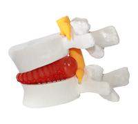 Joygoodta Modèle de Colonne Lombaire, modèle d'enseignement de hernie discale, modèles d'anatomie vertèbre Lombaire en PVC Grandeur Nature 1, 5X pour l'éducation, Blanc