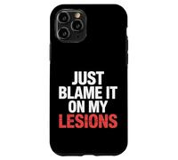 Just Blame It on My Lesions Sclérose en plaques |- Coque pour iPhone 11 Pro