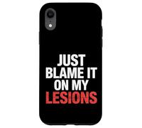 Just Blame It on My Lesions Sclérose en plaques |- Coque pour iPhone XR