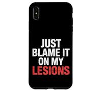 Just Blame It on My Lesions Sclérose en plaques |- Coque pour iPhone XS Max