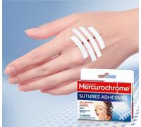 Kalanka-Mercurochrome Sutures Adhésives - Plaies Superficielles Et Incisions Chirurgicales, Stérile, Haute Tolérance, Cutanée, 2 Sachets De 5 Bandelettes De 75 X 3 Mm Et 3 De 75 X 6 Mm (Lot De 3)