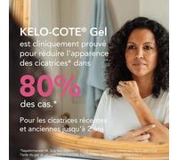 Kalanka-- Tube 6g - Gel Pour Traitement Des Cicatrices - Formule Silicone - Atténue Rougeurs & Démangeaisons - Résiste À L¿Eau - Transparent - Cliniquement Prouvé