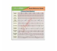 KCDFDVJFBM 12 Lead ECG Quick Reference Poster Heart Rhythm Interpretation Guide Canvas Print Clinical Knowledge Wall-Art for Study Room Clinic(Unframed,08x12inch(20x30cm))