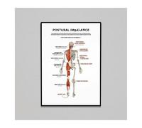 KCDFDVJFBM Anatomy of Posture Educational Poster vs Poor Posture Chart for Spine Health and Body Mechanics School Office Decor(Framed,08x12inch(20x30cm))