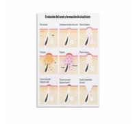 KCDFDVJFBM Cross Section of Human Skin Canvas Wall-Art Detailed Skin Anatomy Poster Biology Study Chart for Office Decor(Framed,16x24inch(40x60cm))