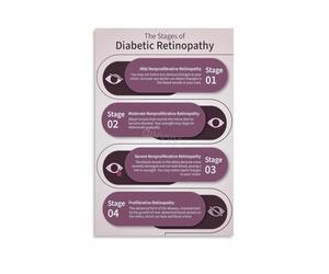 KCDFDVJFBM Diabetic Retinopathy Anatomy and Stages Poster Educational Visual Guide Eye Disease Symptoms Chart for Patient Education Clinic Hospital Decor(Unframed,08x12inch(20x30cm))