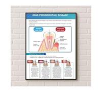KCDFDVJFBM Health Educational Chart Oral Hygiene and Gum Care Guide Poster Showing Plaque and Tartar Wall-Art for Office(Framed,08x12inch(20x30cm))