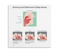 KCDFDVJFBM Stages of sleep educational chart human biology poster canvas Wall-Art print for classroom office study room home decor(Framed,16x24inch(40x60cm))