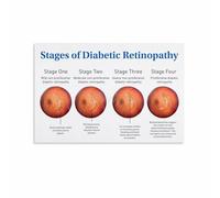 KCDFDVJFBM Vision Care Educational Chart Canvas Print Eye Anatomy Health Knowledge Guide Informative Poster for Doctor Office Clinic Wall Decor Gift(Unframed,08x12inch(20x30cm))