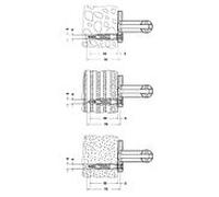 KEUCO PLAN Care Set de fixation 1, 3xvis à bois, 34990000100