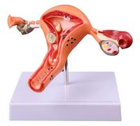 Keuyeo Modèle D'ovaire De L'utérus Modèle Anatomique Pathologique De L'ovaire De L'utérus Outil D'étude De Section Transversale D'anatomie Modèle D'accessoires Médicaux