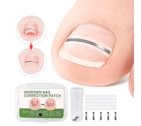 INF Kit de 10 patchs pour corriger les ongles incarnés 16 mm