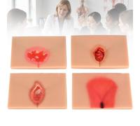 Kit de Modèles Escarre Stades I-IV pour Formation en Soins