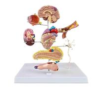 Kit de modélisation du diabète de type II chez l'homme, | Maquettes miniatures du cerveau, de l'œil, du cœur, du rein, d'une artère, du pancréas