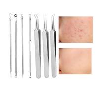 Kit d'extracteur à bouton, kit d'extracteur Comedone,Outils de nettoyant en pores 7x en acier inoxydable | Têtises de cueillette de pores de nez sale outil de retrait pour le visage whitehead