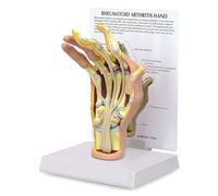 KJMWXOP Modèle de pathologie de la Main, modèle de Main atteinte d'arthrite rhumatoïde, réplique de l'anatomie de la Main, Outils pédagogiques médicaux pour l'étude des tendons d