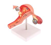 KMHHAG Modèle pathologique du système reproducteur féminin pour l'enseignement et l'affichage