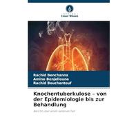 Knochentuberkulose - von der Epidemiologie bis zur Behandlung