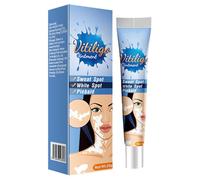 KOAHDE Crème De Traitement Du Vitiligo,Crème De Vitiligo,Crème De Soin Vitiligo Pour La Peau Vitiligo,Vitiligo Pommade,Crème pour le Traitement des Taches Blanches,20G